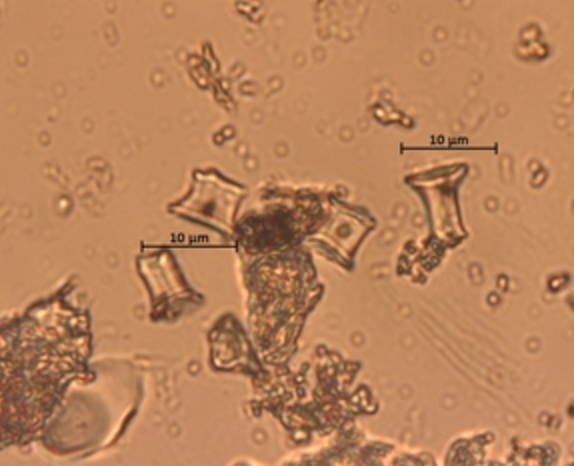 Specimen from Shalen Prado's Microbotanical Specimen Database: Rondel phytoliths.